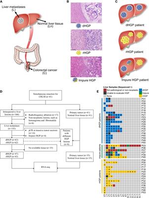 Delineating the molecular landscape of different histopathological growth patterns in colorectal cancer liver metastases